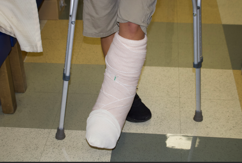 Preuss student Daniel Yiv's leg in a cast